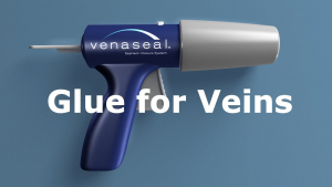 Лечение варикоза биоклеем Venaseal